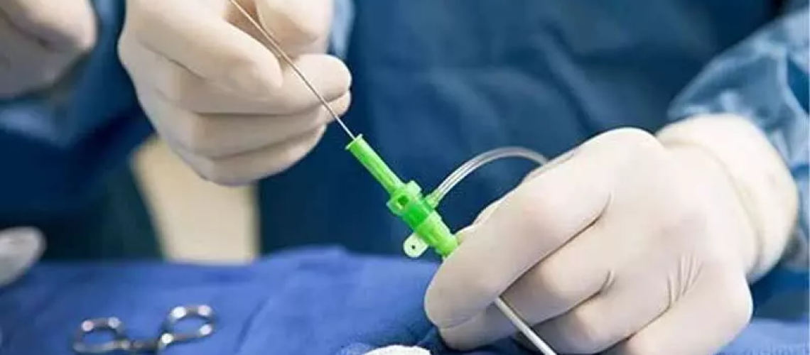 ابلیشن قلبی در رشت